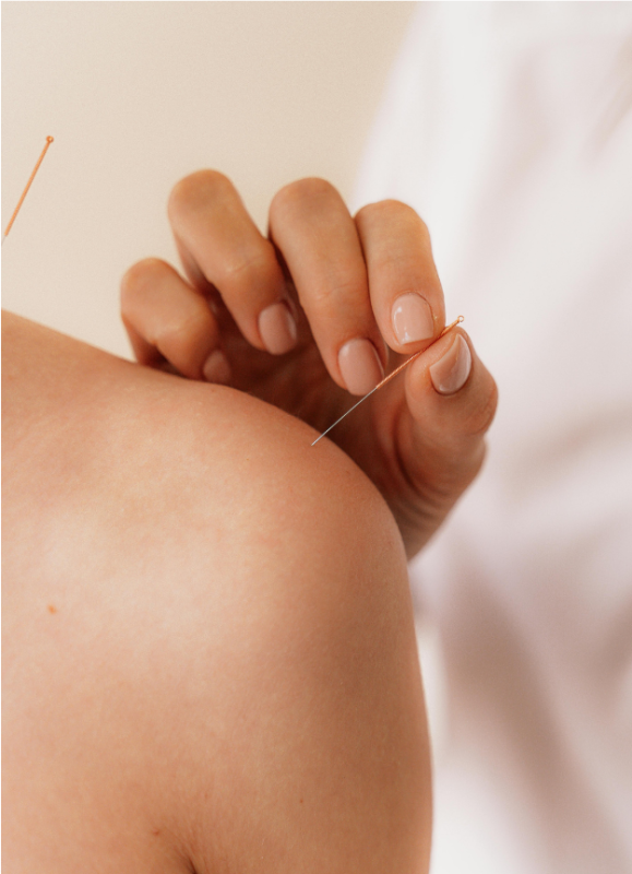 Acupuncture et acupression